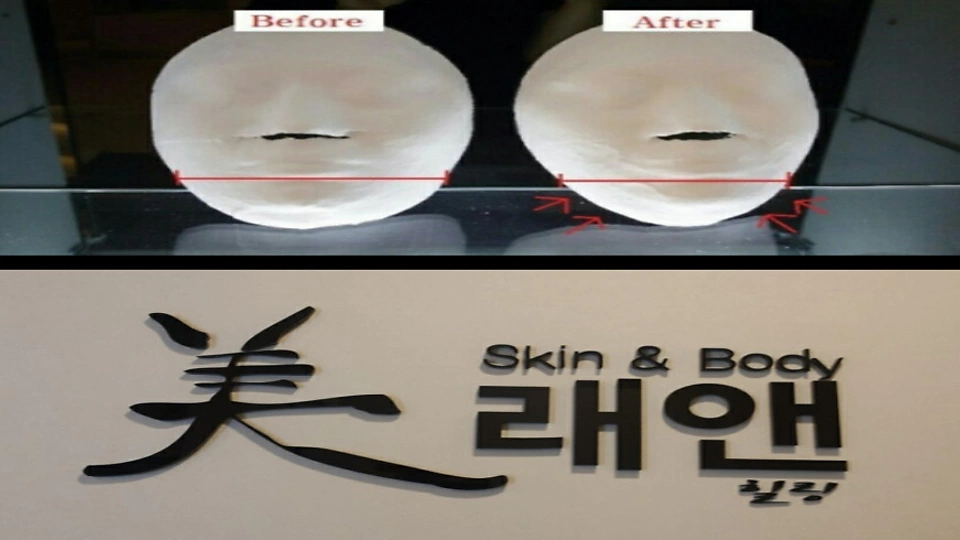 수택동 에스테틱 미래앤스킨케어10