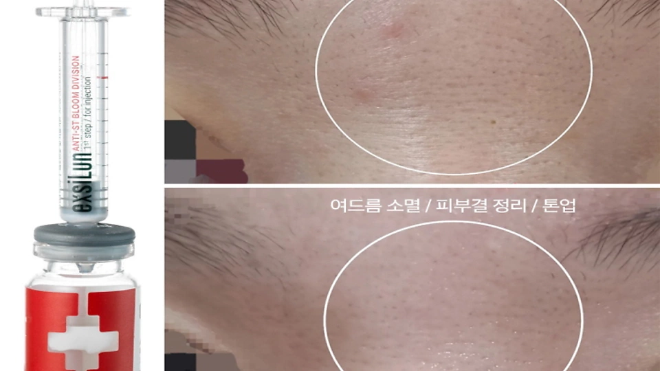 명동 에스테틱 스킨스파09