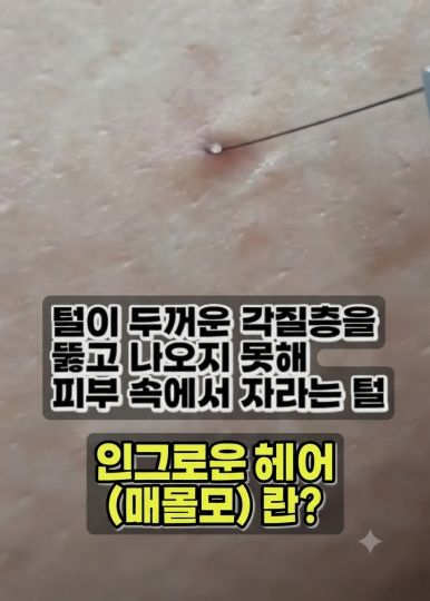 잠실동 마사지 수아르18