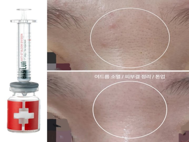 명동 에스테틱 스킨스파09