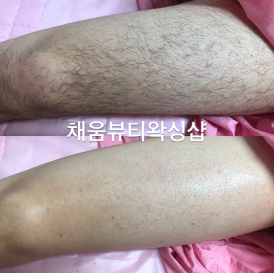 삼성동 왁싱 채움뷰티왁싱샵03
